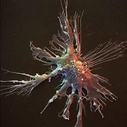Нобелевская премия 2011. Ральф Стайман. Dendritic-cell