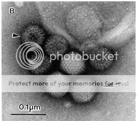 Как Выглядят Вирусы Под Микроскопом Фото